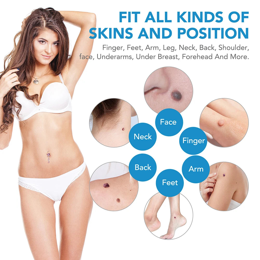 2 IN 1 Auto Micro Skin Tag Remover Device