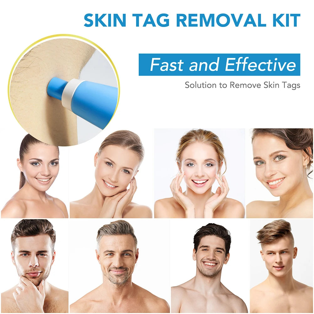 2 IN 1 Auto Micro Skin Tag Remover Device