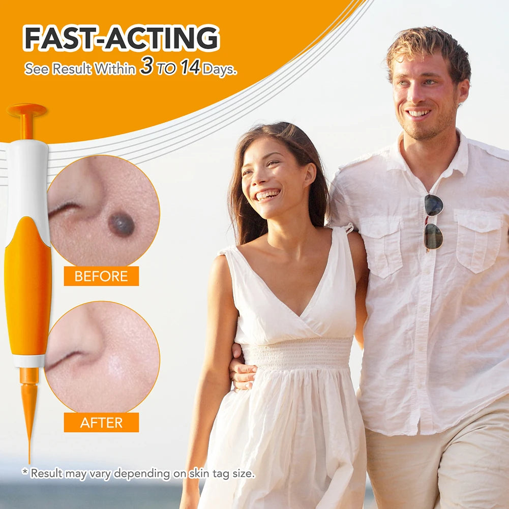 2 IN 1 Auto Micro Skin Tag Remover Device