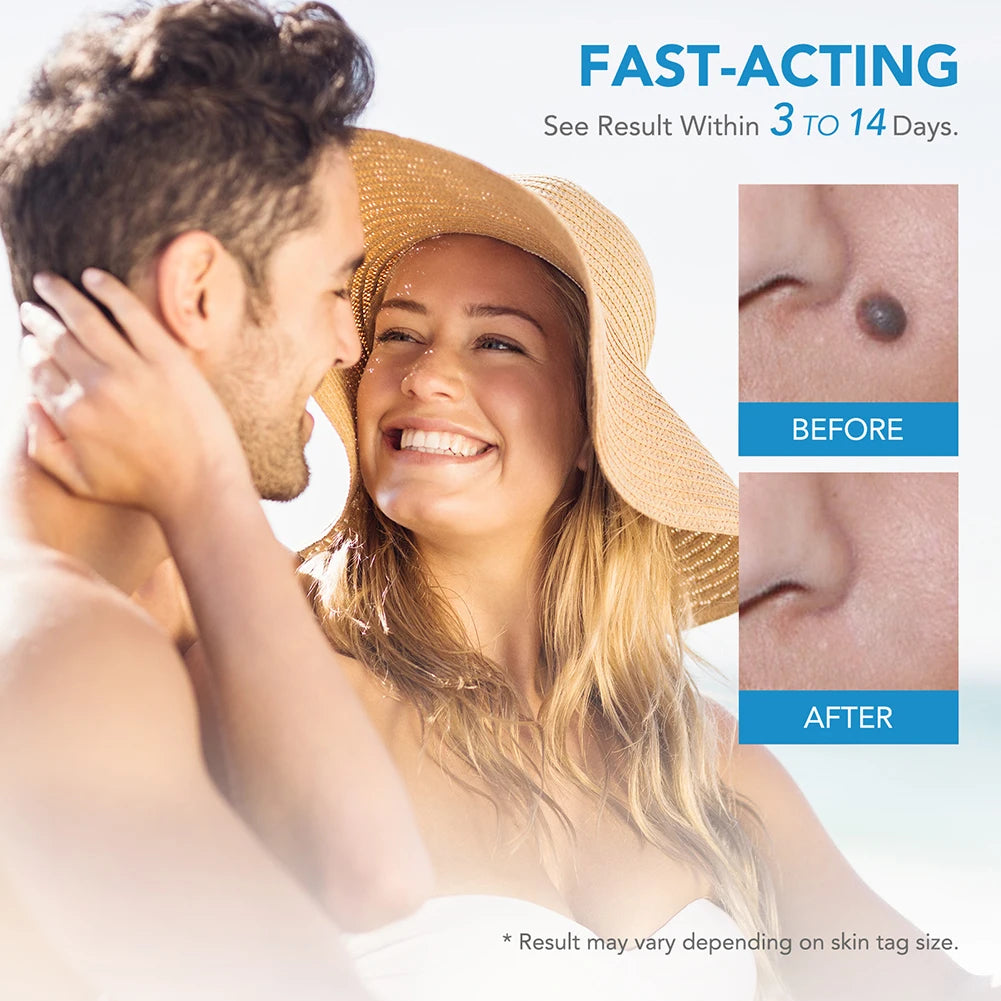 2 IN 1 Auto Micro Skin Tag Remover Device