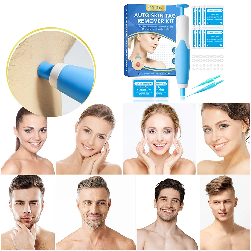 2 IN 1 Auto Micro Skin Tag Remover Device