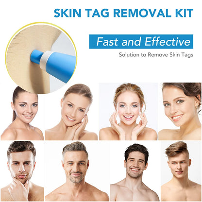 2 IN 1 Auto Micro Skin Tag Remover Device