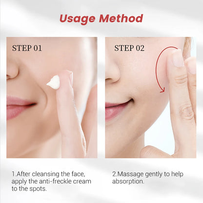 20g Whitening Freckle Cream Remove Dark Spot Cream