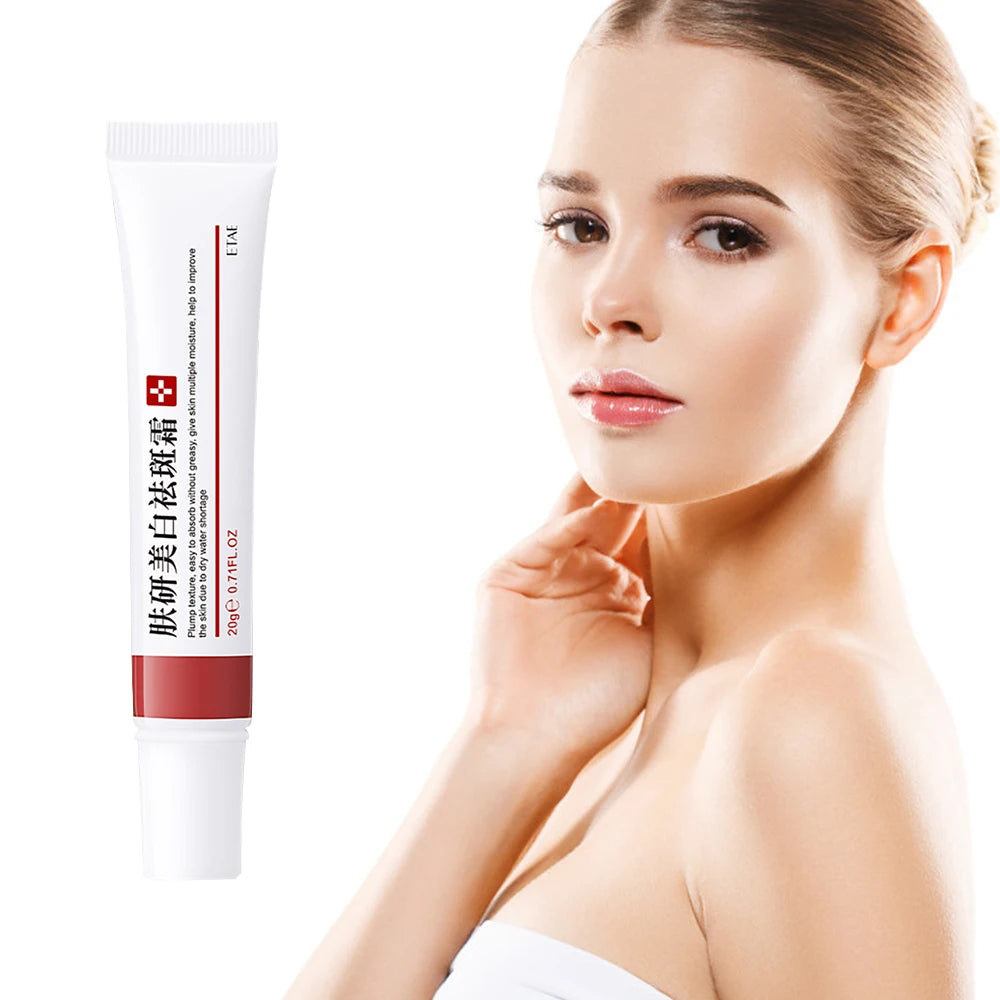 20g Whitening Freckle Cream Remove Dark Spot Cream
