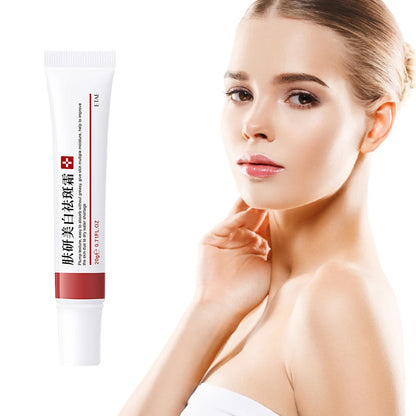 20g Whitening Freckle Cream Remove Dark Spot Cream